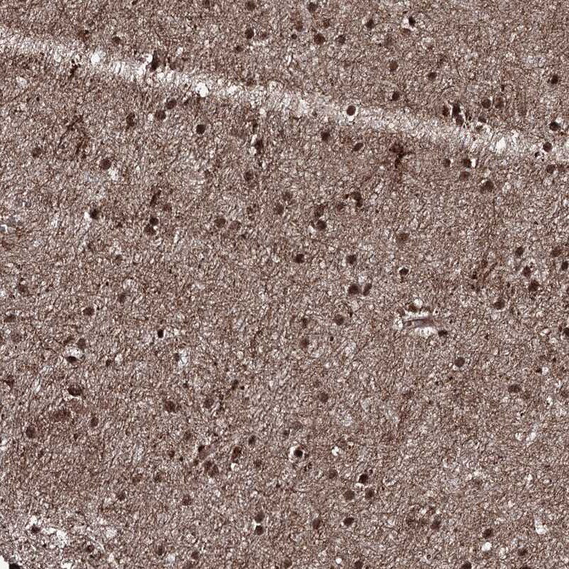 FNBP3 Antibody - BSA Free Immunohistochemistry-Paraffin: FNBP3 Antibody [NBP2-38400]