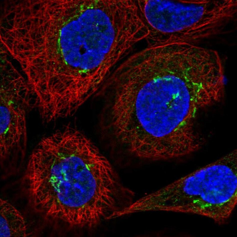 VDP p115 Antibody - BSA Free Immunocytochemistry/ Immunofluorescence: VDP p115 Antibody [NBP2-38401]