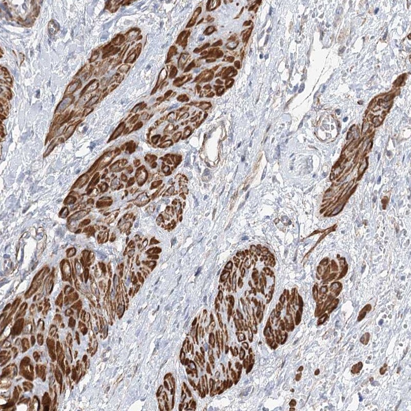 coiled-coil domain containing 53 Antibody - BSA Free Immunohistochemistry-Paraffin: coiled-coil domain containing 53 Antibody [NBP2-38406]
