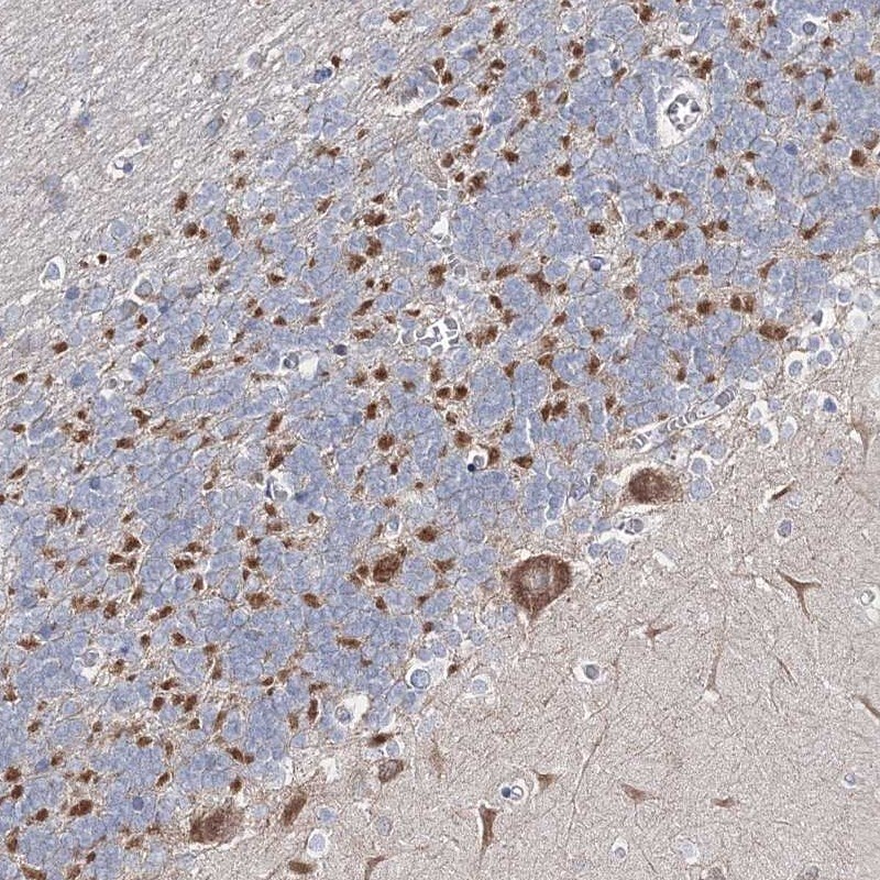 RICS Antibody - BSA Free Immunohistochemistry: RICS Antibody - BSA Free [NBP2-38408]