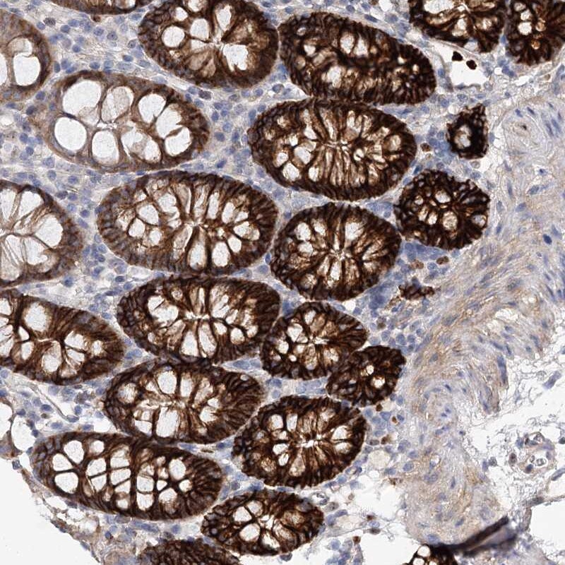C11orf52 Antibody - BSA Free Immunohistochemistry-Paraffin: C11orf52 Antibody [NBP2-38409]