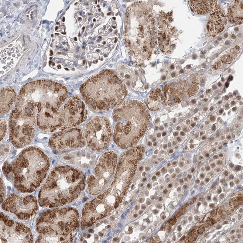 ADK Antibody - BSA Free Immunohistochemistry: ADK Antibody - BSA Free [NBP2-38410]