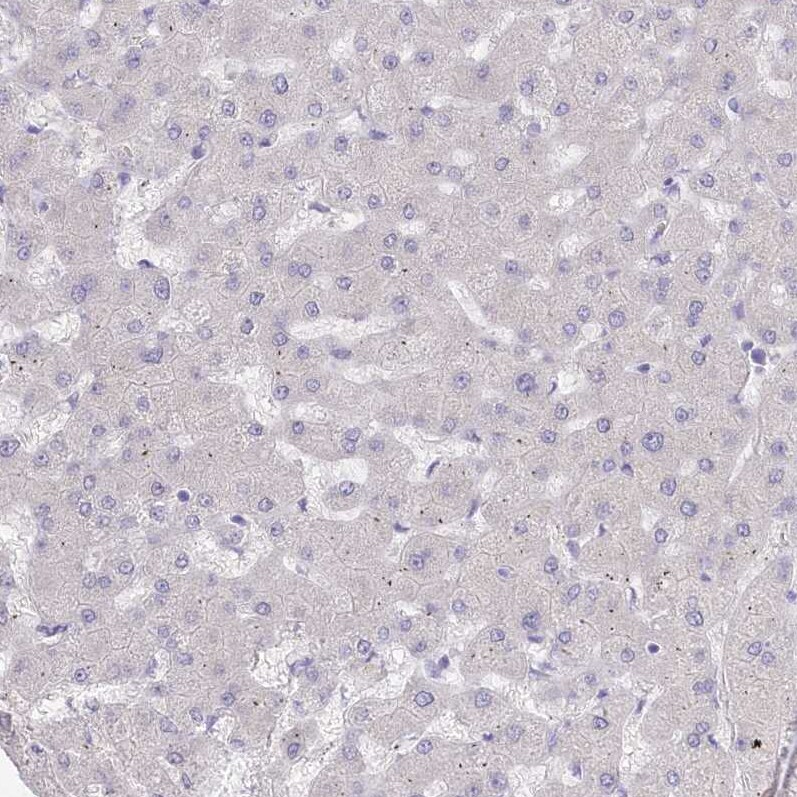 Myozenin 1 Antibody - BSA Free Immunohistochemistry-Paraffin: Myozenin 1 Antibody [NBP2-38412]