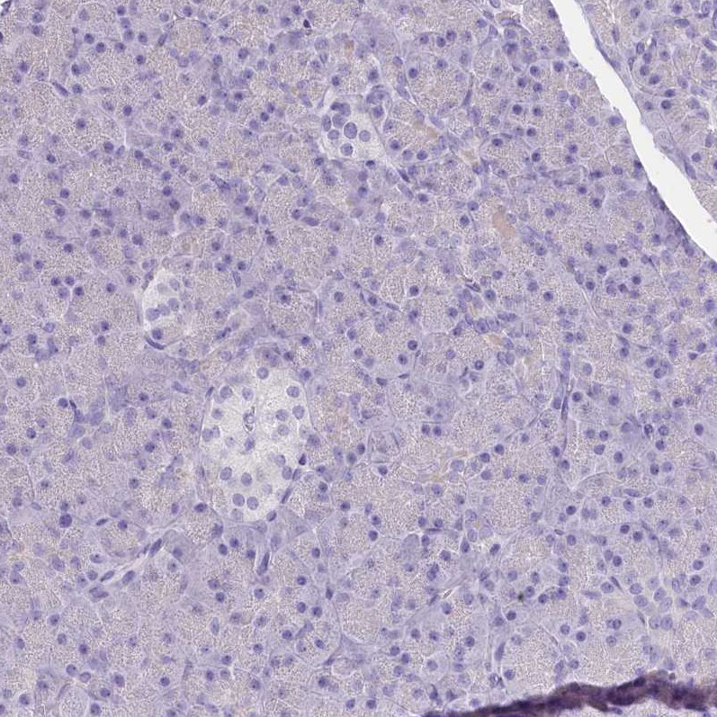 Myozenin 1 Antibody - BSA Free Immunohistochemistry-Paraffin: Myozenin 1 Antibody [NBP2-38412]