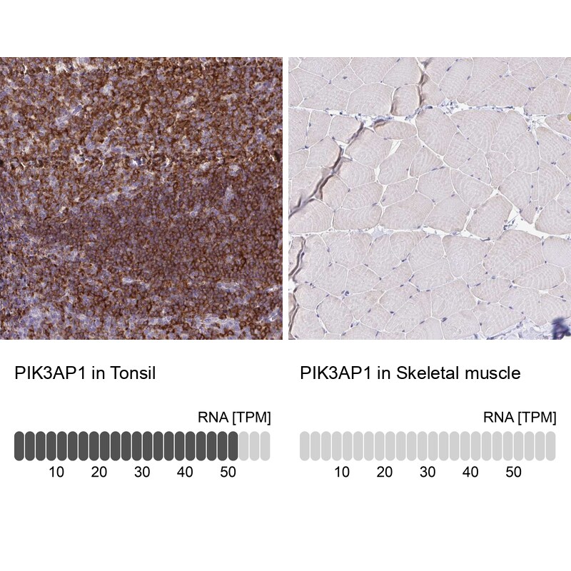 BCAP/PIK3AP1 Antibody - BSA Free Immunohistochemistry-Paraffin: BCAP/PIK3AP1 Antibody [NBP2-38413]