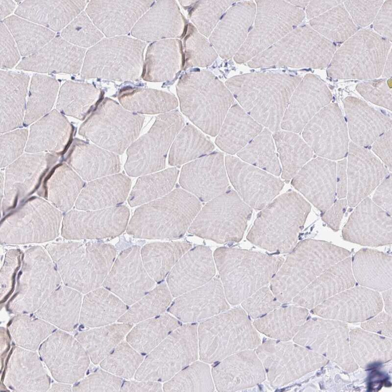 BCAP/PIK3AP1 Antibody - BSA Free Immunohistochemistry-Paraffin: BCAP/PIK3AP1 Antibody [NBP2-38413]