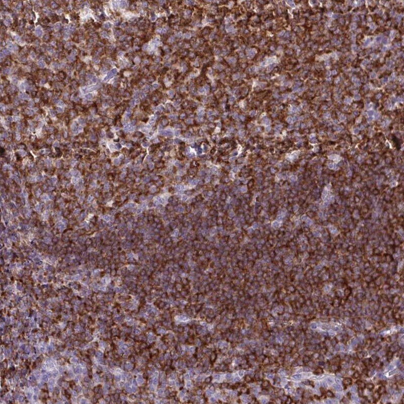 BCAP/PIK3AP1 Antibody - BSA Free Immunohistochemistry-Paraffin: BCAP/PIK3AP1 Antibody [NBP2-38413]