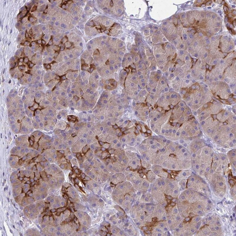 BCAP/PIK3AP1 Antibody - BSA Free Immunohistochemistry-Paraffin: BCAP/PIK3AP1 Antibody [NBP2-38413]