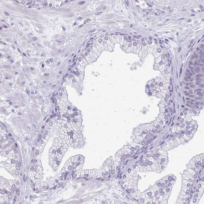 BCAP/PIK3AP1 Antibody - BSA Free Immunohistochemistry-Paraffin: BCAP/PIK3AP1 Antibody [NBP2-38413]