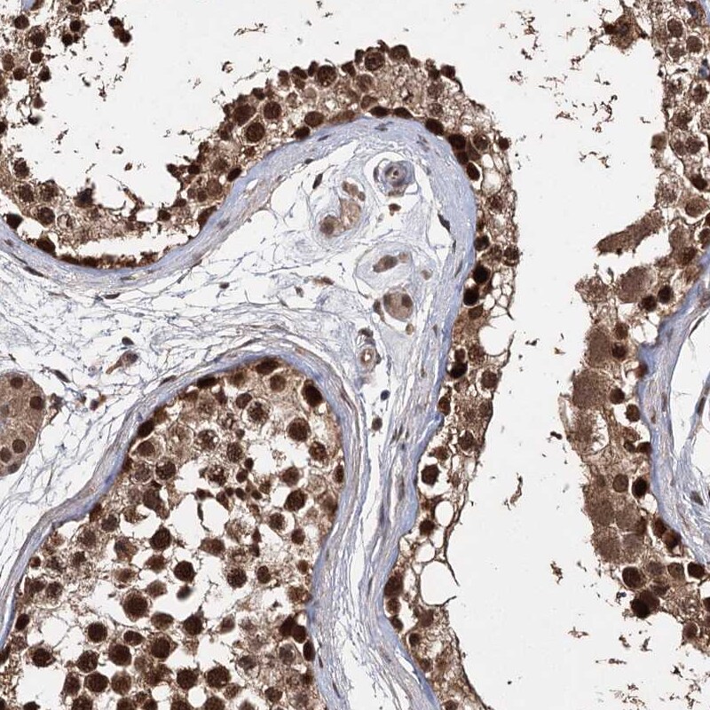 MYG1 Antibody - BSA Free Immunohistochemistry-Paraffin: MYG1 Antibody [NBP2-38422]
