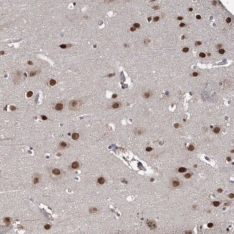 MYG1 Antibody - BSA Free Immunohistochemistry-Paraffin: MYG1 Antibody [NBP2-38422]