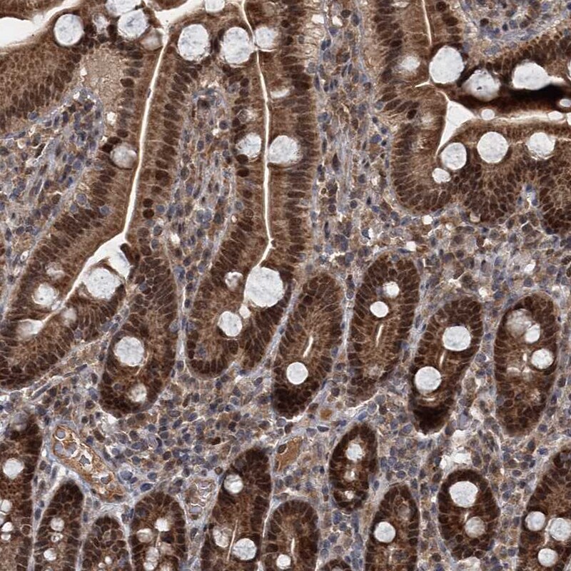 MYG1 Antibody - BSA Free Immunohistochemistry-Paraffin: MYG1 Antibody [NBP2-38422]