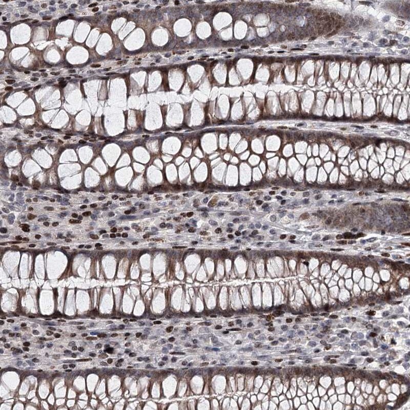 MDS028 Antibody - BSA Free Immunohistochemistry: MDS028 Antibody - BSA Free [NBP2-38424]
