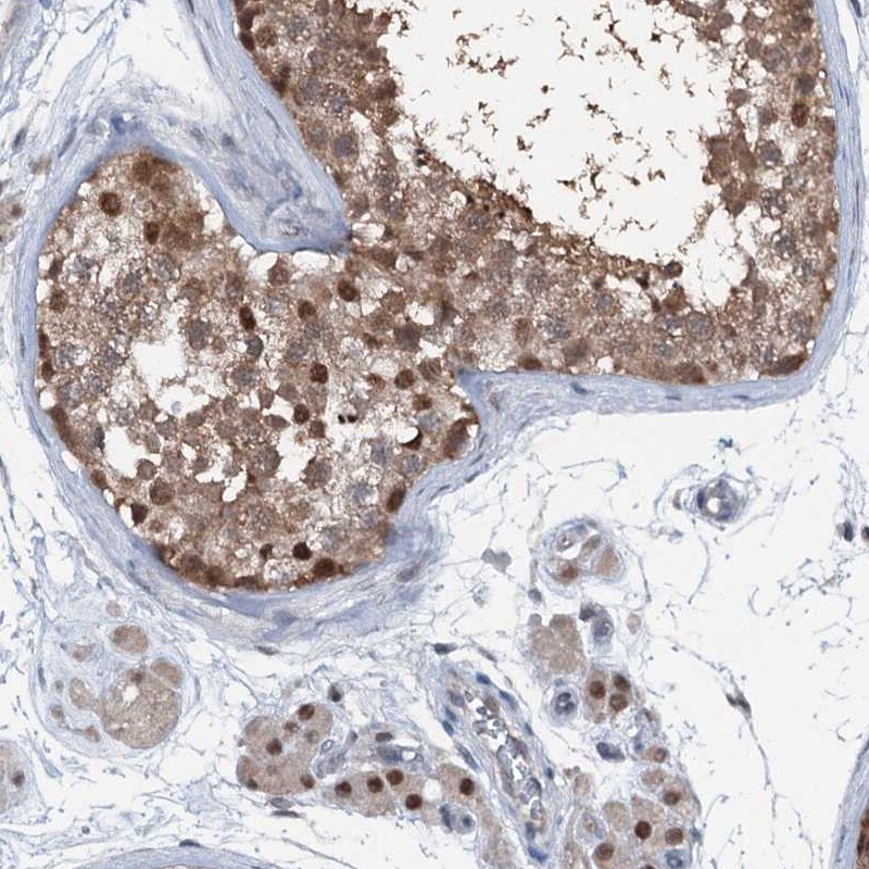 PSMD13 Antibody - BSA Free Immunohistochemistry-Paraffin: PSMD13 Antibody [NBP2-38426]