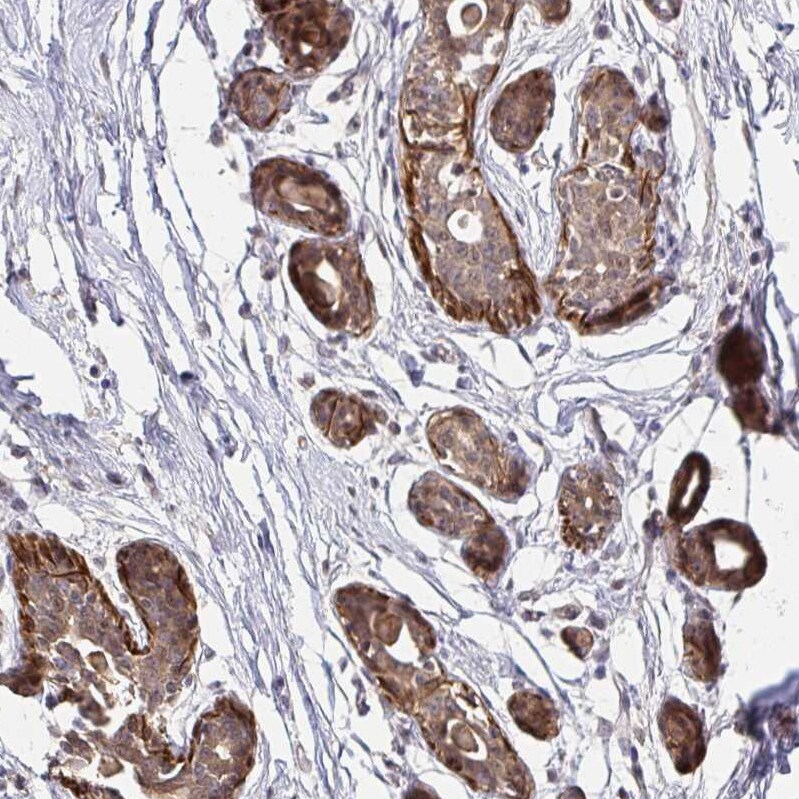 YAP1 Antibody - BSA Free Immunohistochemistry: YAP1 Antibody - BSA Free [NBP2-38430]