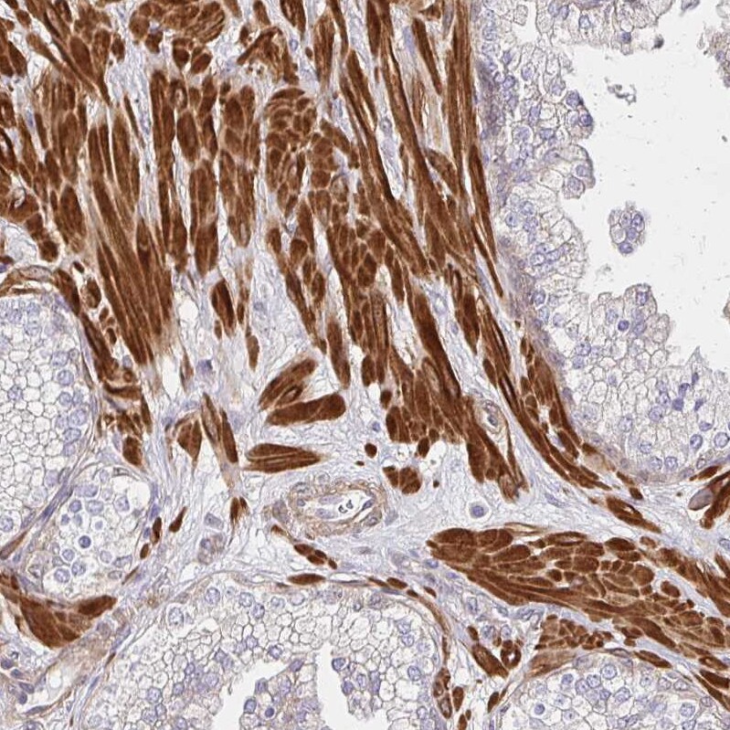 YAP1 Antibody - BSA Free Immunohistochemistry: YAP1 Antibody - BSA Free [NBP2-38430]