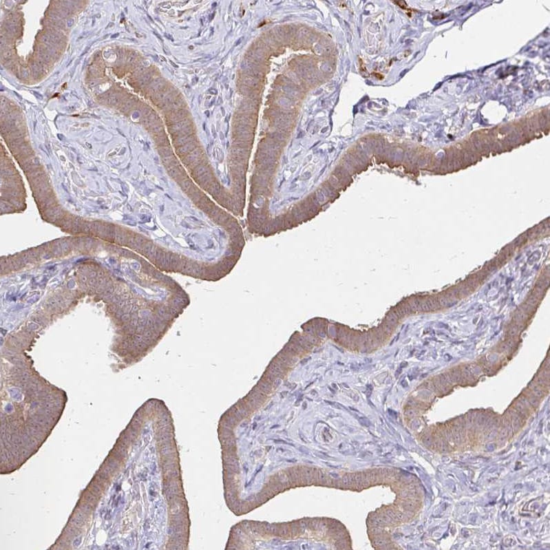 YAP1 Antibody - BSA Free Immunohistochemistry: YAP1 Antibody - BSA Free [NBP2-38430]
