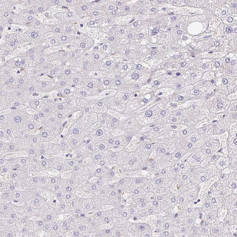 YAP1 Antibody - BSA Free Immunohistochemistry: YAP1 Antibody - BSA Free [NBP2-38430]