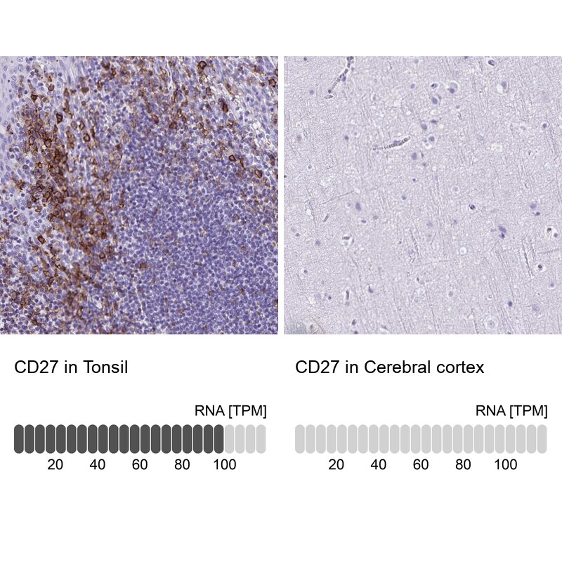 CD27/TNFRSF7 Antibody - BSA Free Immunohistochemistry-Paraffin: CD27/TNFRSF7 Antibody [NBP2-38434]