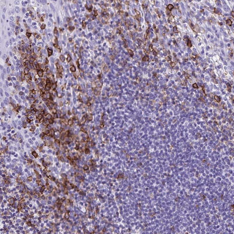 CD27/TNFRSF7 Antibody - BSA Free Immunohistochemistry-Paraffin: CD27/TNFRSF7 Antibody [NBP2-38434]