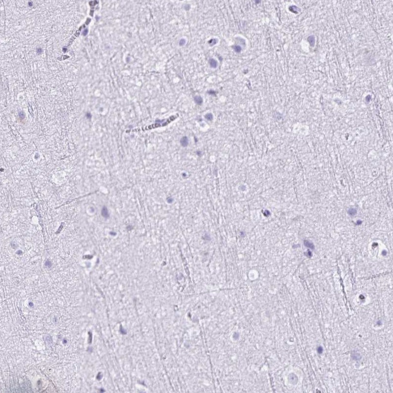 CD27/TNFRSF7 Antibody - BSA Free Immunohistochemistry-Paraffin: CD27/TNFRSF7 Antibody [NBP2-38434]