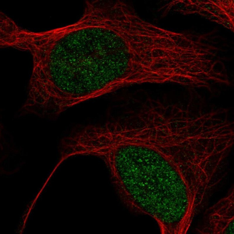 MBD6 Antibody - BSA Free Immunocytochemistry/ Immunofluorescence: MBD6 Antibody [NBP2-38435]