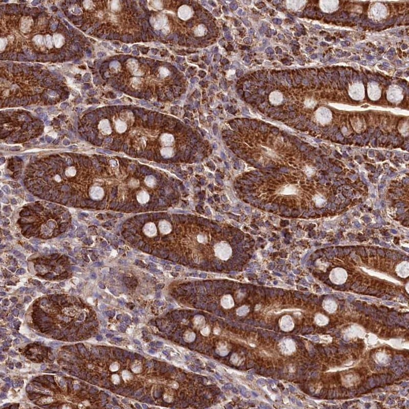 NUDT15 Antibody - BSA Free Immunohistochemistry: NUDT15 Antibody - BSA Free [NBP2-38436]