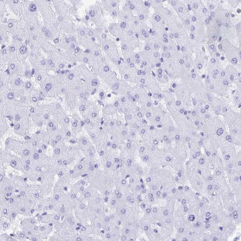 CD7 Antibody - BSA Free Immunohistochemistry-Paraffin: CD7 Antibody [NBP2-38440]
