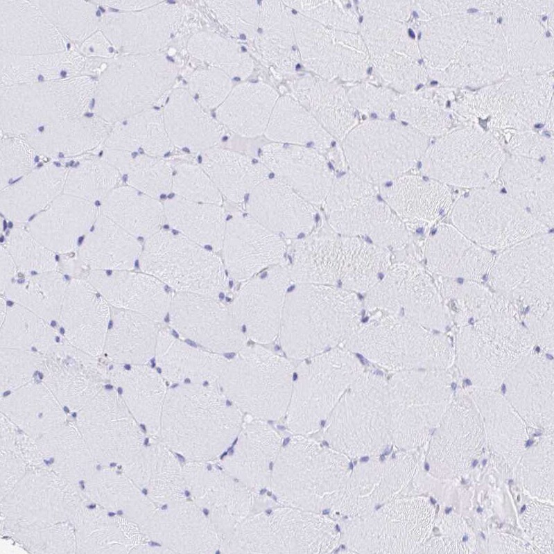 CD7 Antibody - BSA Free Immunohistochemistry-Paraffin: CD7 Antibody [NBP2-38440]