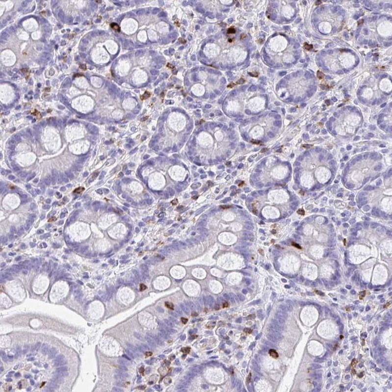 CD7 Antibody - BSA Free Immunohistochemistry-Paraffin: CD7 Antibody [NBP2-38440]