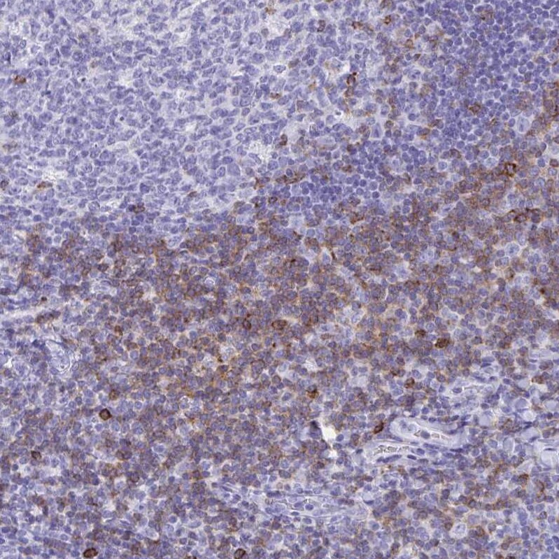 CD7 Antibody - BSA Free Immunohistochemistry-Paraffin: CD7 Antibody [NBP2-38440]