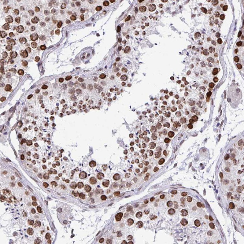 BANF1 Antibody - BSA Free Immunohistochemistry-Paraffin: BANF1 Antibody [NBP2-38442]
