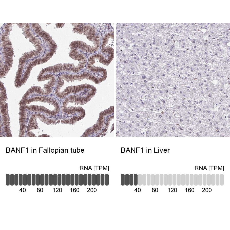 BANF1 Antibody - BSA Free Immunohistochemistry-Paraffin: BANF1 Antibody [NBP2-38442]