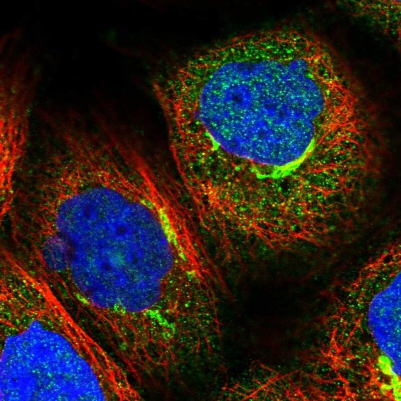 PEX5 Antibody - BSA Free Immunocytochemistry/ Immunofluorescence: PEX5 Antibody [NBP2-38443]