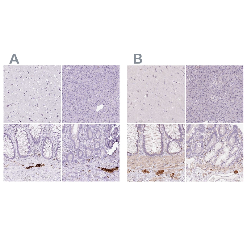Peripherin Antibody - BSA Free Immunohistochemistry: Peripherin Antibody - BSA Free [NBP2-38444]