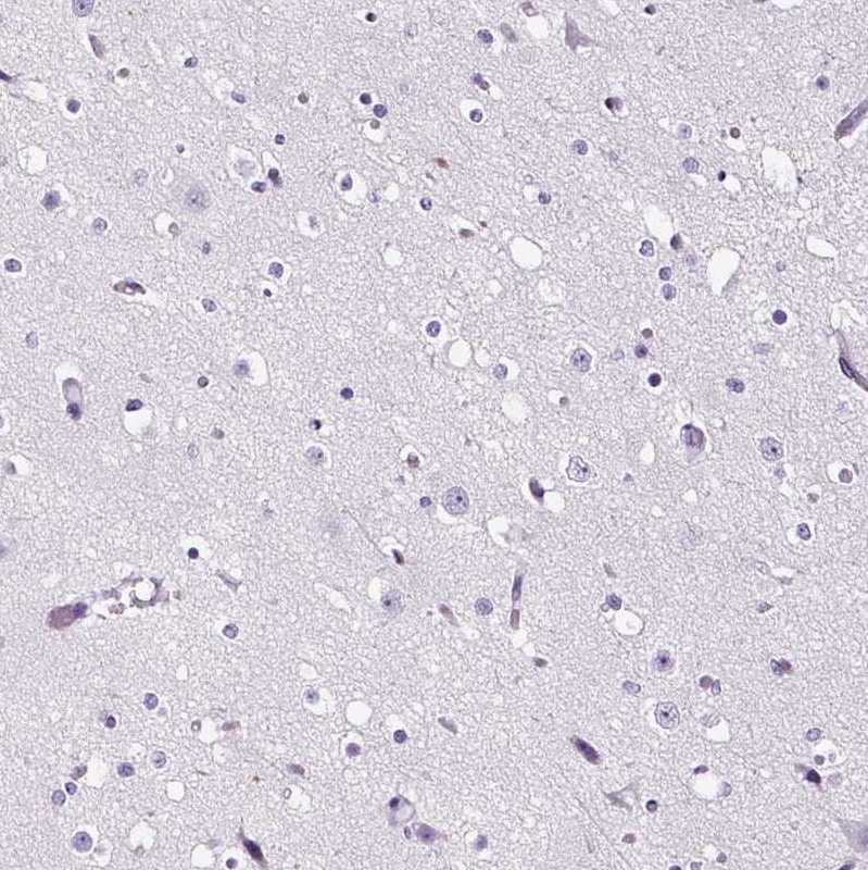 Peripherin Antibody - BSA Free Immunohistochemistry: Peripherin Antibody - BSA Free [NBP2-38444]