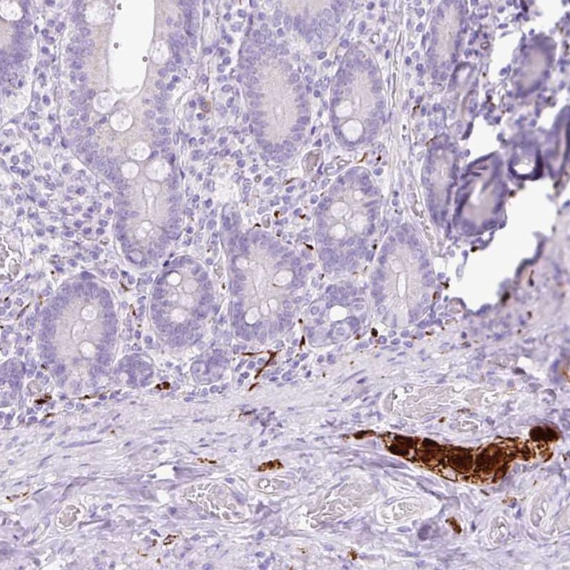 Peripherin Antibody - BSA Free Immunohistochemistry: Peripherin Antibody - BSA Free [NBP2-38444]