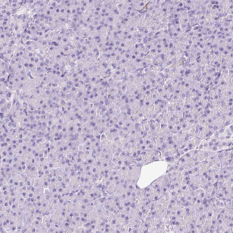 Peripherin Antibody - BSA Free Immunohistochemistry: Peripherin Antibody - BSA Free [NBP2-38444]