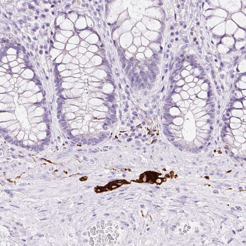 Peripherin Antibody - BSA Free Immunohistochemistry: Peripherin Antibody - BSA Free [NBP2-38444]