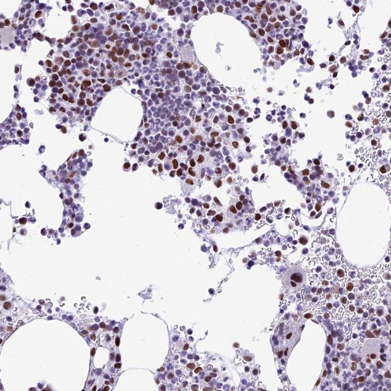 p70 S6 Kinase/S6K Antibody - BSA Free Immunohistochemistry-Paraffin: p70 S6 Kinase/S6K Antibody [NBP2-38448]