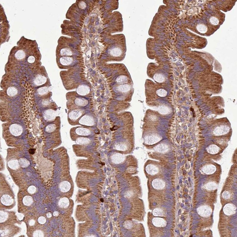 PLEKHM1 Antibody - BSA Free Immunohistochemistry-Paraffin: PLEKHM1 Antibody [NBP2-38449]