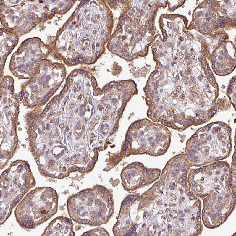PLEKHM1 Antibody - BSA Free Immunohistochemistry-Paraffin: PLEKHM1 Antibody [NBP2-38449]