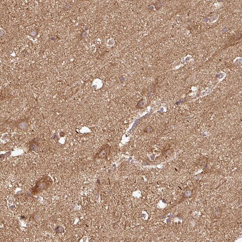 PLEKHM1 Antibody - BSA Free Immunohistochemistry-Paraffin: PLEKHM1 Antibody [NBP2-38449]