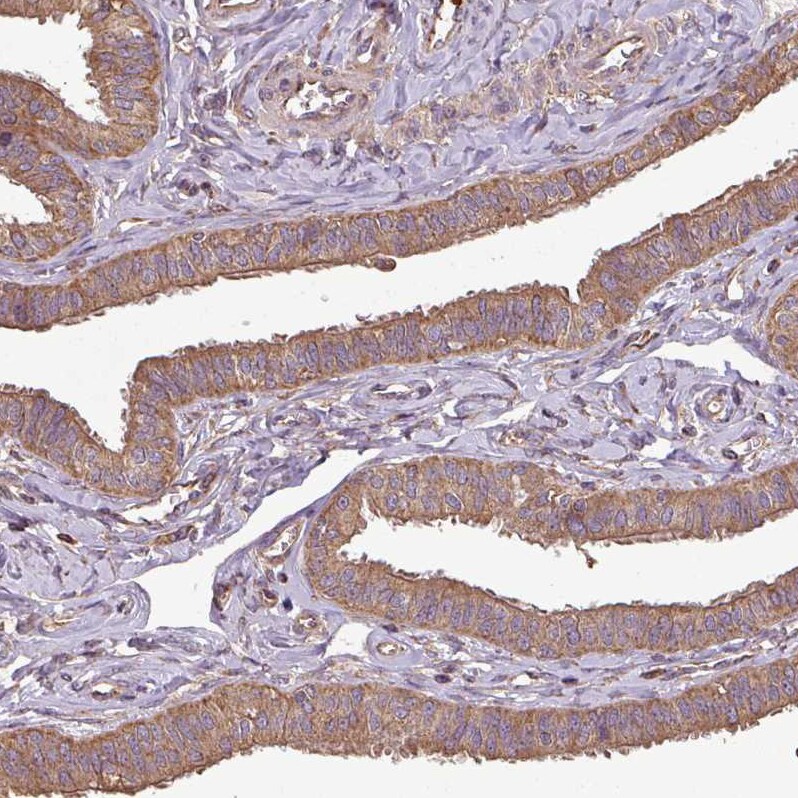 PLEKHM1 Antibody - BSA Free Immunohistochemistry-Paraffin: PLEKHM1 Antibody [NBP2-38449]