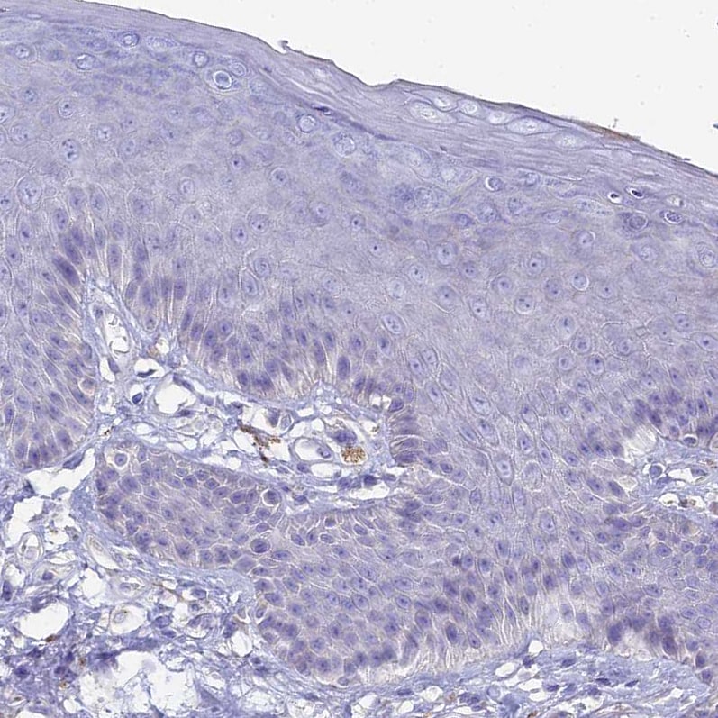 NCAM-1/CD56 Antibody - BSA Free Immunohistochemistry-Paraffin: NCAM-1/CD56 Antibody [NBP2-38452]
