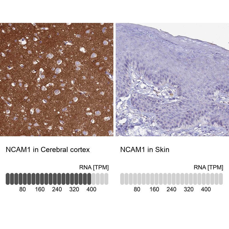 NCAM-1/CD56 Antibody - BSA Free Immunohistochemistry-Paraffin: NCAM-1/CD56 Antibody [NBP2-38452]