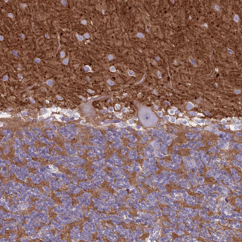 NCAM-1/CD56 Antibody - BSA Free Immunohistochemistry-Paraffin: NCAM-1/CD56 Antibody [NBP2-38452]