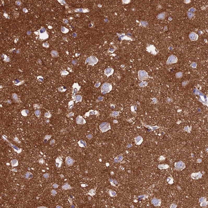 NCAM-1/CD56 Antibody - BSA Free Immunohistochemistry-Paraffin: NCAM-1/CD56 Antibody [NBP2-38452]