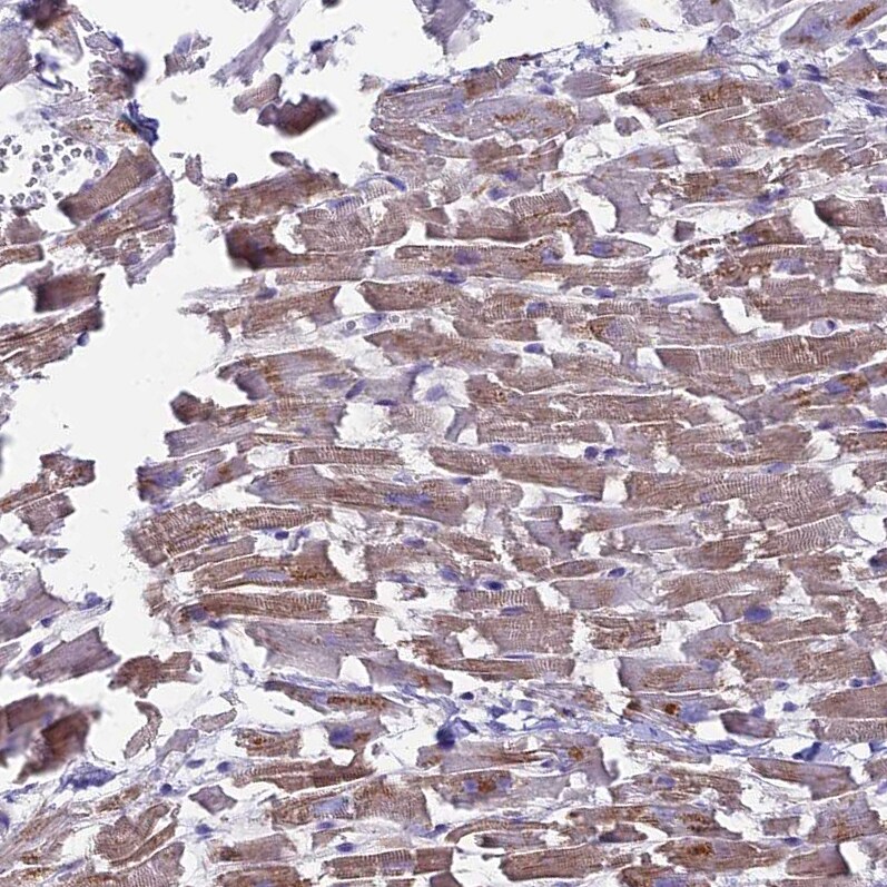 NCAM-1/CD56 Antibody - BSA Free Immunohistochemistry-Paraffin: NCAM-1/CD56 Antibody [NBP2-38452]