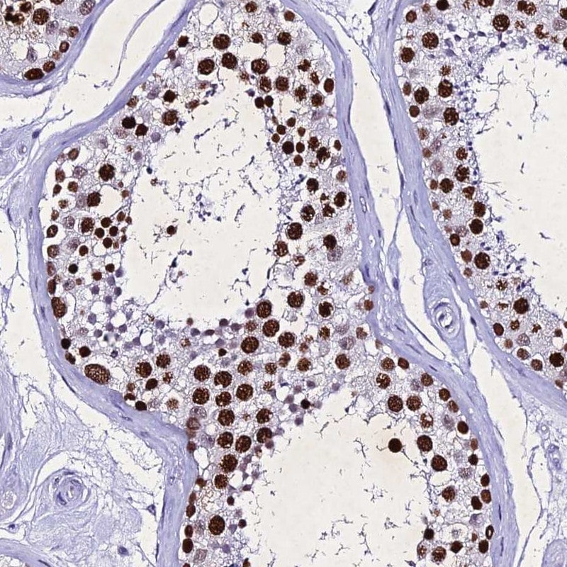 PPP4R2 Antibody - BSA Free Immunohistochemistry-Paraffin: PPP4R2 Antibody [NBP2-38453]